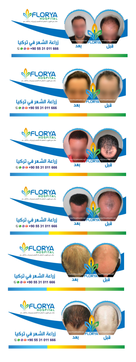  كيفية إجراء عملية زراعة الشعر في تركيا ملف شامل ومتكامل P_938y5fwv1